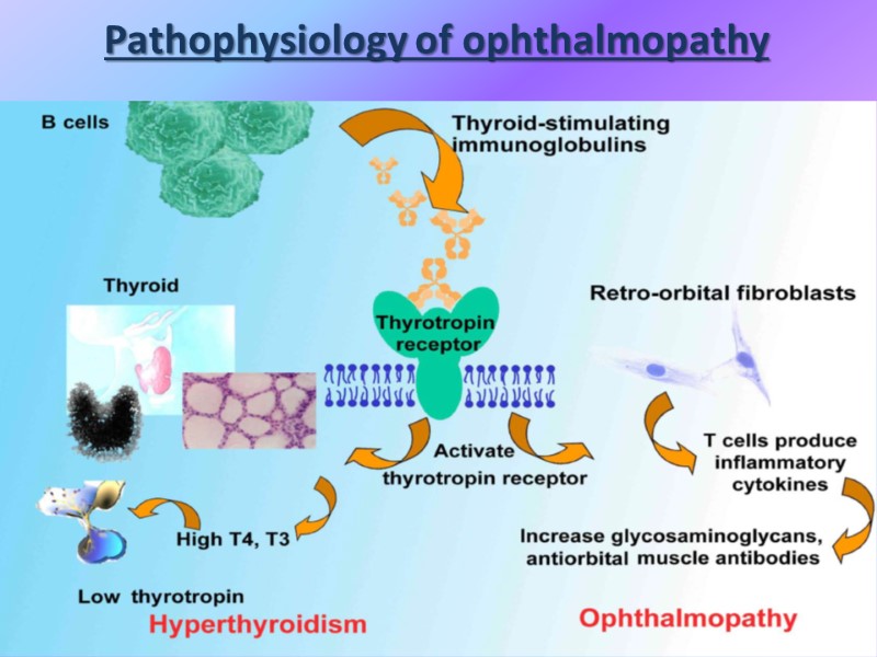 Pathophysiology of ophthalmopathy